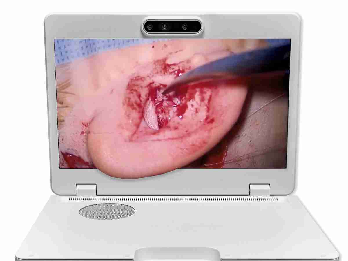 达擎之＂Heads-up 3D显微手术显示系统＂，，整合4K裸眼3D显示及眼球追踪系统，，，具备快速追踪人眼移动位置功能，，，，减轻医师长时间维持固定姿势的负担，，，让医师能有更宽广清晰的3D立体视野及更舒适的姿势来执行手术。。。